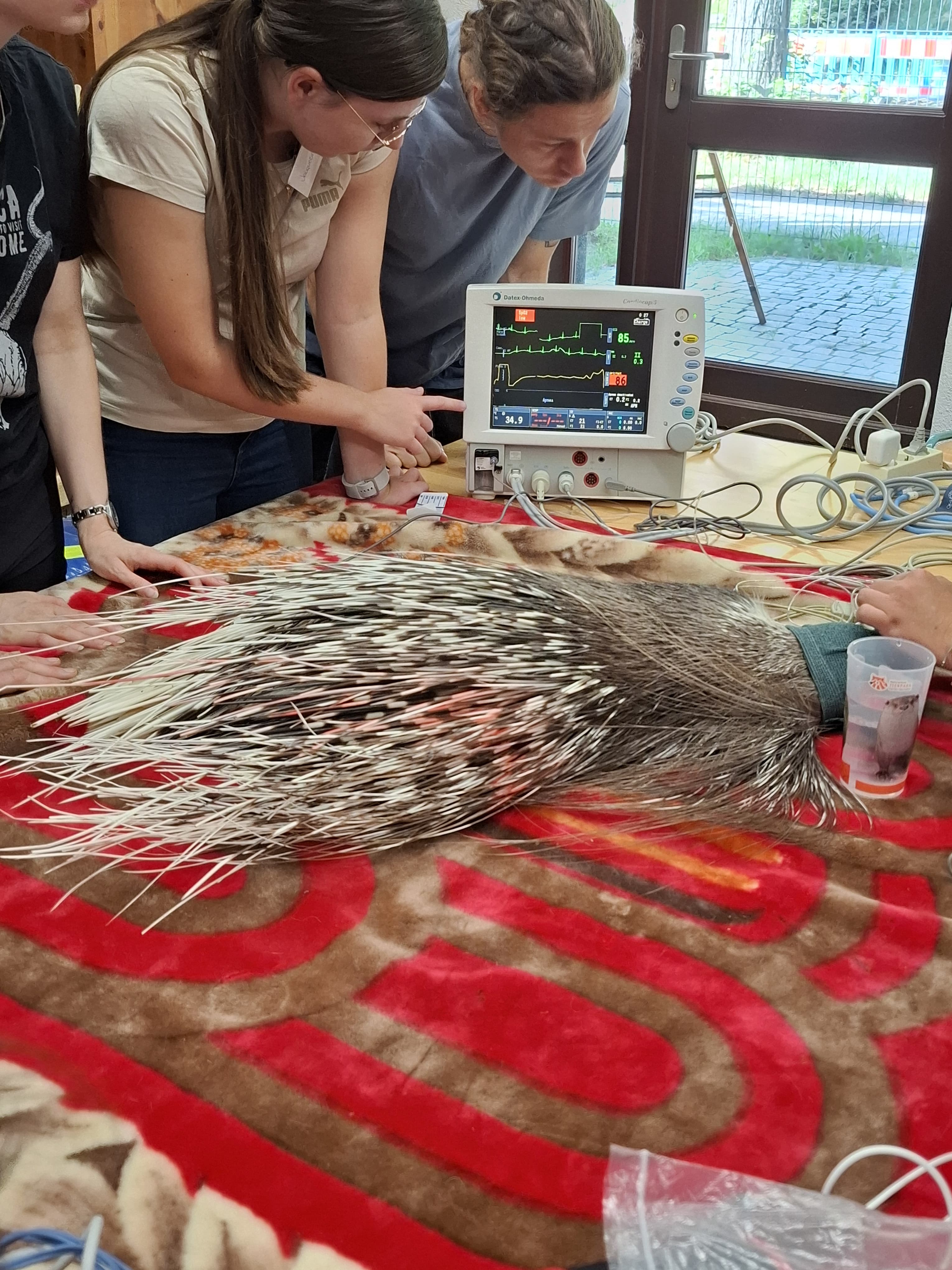 Monitoring anaesthesia