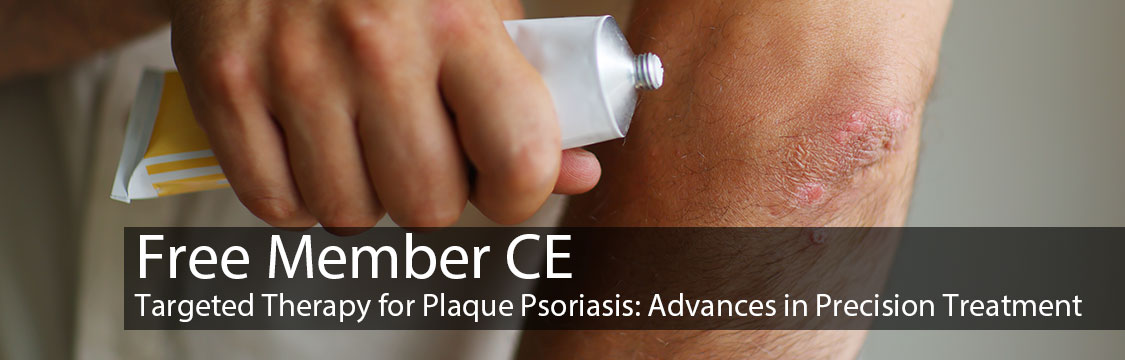 Free Member CE: Targeted Therapy for Plaque Psoriasis