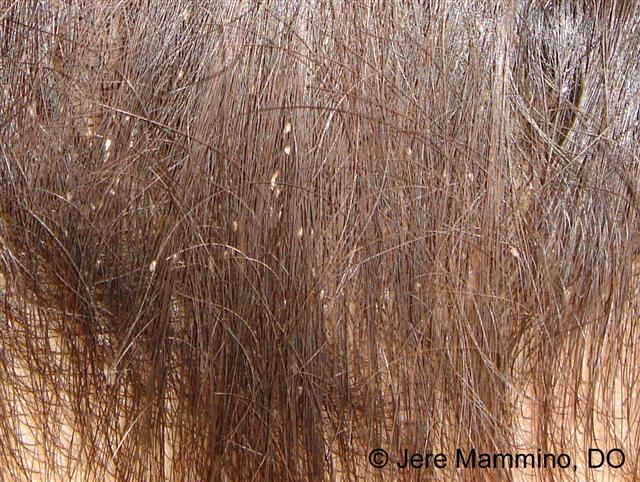 Hairdresser refuses to shave depressed teen's matted hair for school pictures an